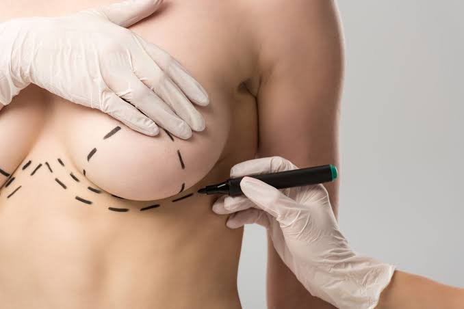 Mais de 14 mil cirurgias mamárias foram feitas pelo SUS
